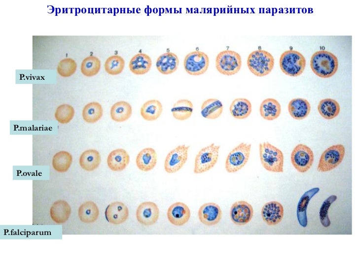 Паразиты симптомы профилактика